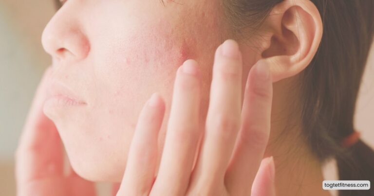 Tips to Prevent Dry Skin in Winters Naturally